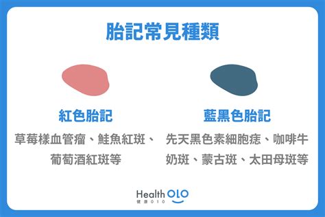 紅色胎記|胎記怎麼產生、何時消除？醫師剖析胎記種類、胎記寓意